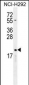 CYBA Antibody (C-term)