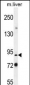 Mouse Parp9 Antibody (N-term)