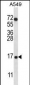 COX7A2L Antibody (Center)