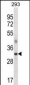 SFRP2 Antibody (C-term)