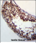 POMT1 Antibody (C-term)