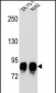 POMT1 Antibody (C-term)