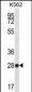 ZNF146 Antibody (N-term)