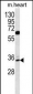 ZNF146 Antibody (N-term)