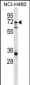 ST6GALNAC1 Antibody (N-term)