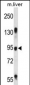 RASAL1 Antibody (Center)