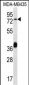 CEL Antibody (Center)