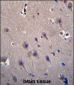 MCF2 Antibody (C-term)