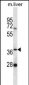 PNKD Antibody (N-term)