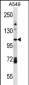 FA13B Antibody (Center)