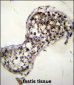 SQLE Antibody (N-term)