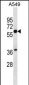 SQLE Antibody (N-term)