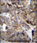 TM4SF1 Antibody (N-term)