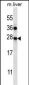 TM4SF1 Antibody (N-term)