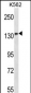 MN1 Antibody (Center)