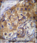 CTAGE5 Antibody (C-term)