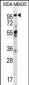 CTAGE5 Antibody (C-term)