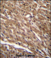 BTG3 Antibody (Center)