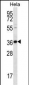 BTG3 Antibody (Center)