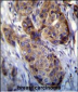 MAGEA12 Antibody (N-term)