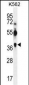 MAGEA12 Antibody (N-term)