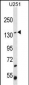 ST5 Antibody (C-term)