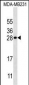 Kallikrein 7 Antibody (Center)