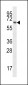 TPTEa Antibody (N-term)