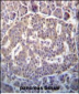 SCYL1 Antibody (N-term)