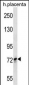 SCYL1 Antibody (N-term)