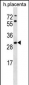 STARD4 Antibody (N-term)