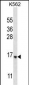 STARD5 Antibody (N-term)