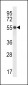 HEPACAM Antibody (C-term)