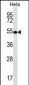 SCHIP1 Antibody (Center)