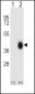 FCAR Antibody (Center)