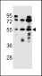 FUT6 Antibody (N-term)