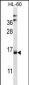 NDUFAF4 Antibody (N-term)