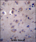 HPSE2 Antibody (C-term)