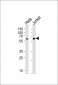 HPSE2 Antibody (C-term)