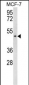 SCD5 Antibody (Center)