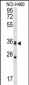 MBNL3 Antibody (Center)