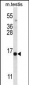 SPT19 Antibody (C-term)