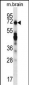 REPS2 Antibody (N-term)