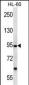 PCDHA12 Antibody (N-term)