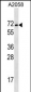 MAGEE2 Antibody (C-term)