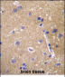 ABCC12 Antibody (Center)