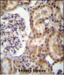 RNF43 Antibody (C-term)