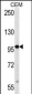 RNF43 Antibody (C-term)