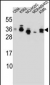 SSX4 Antibody (Center)