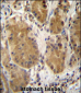 PCDHB5 Antibody (Center)